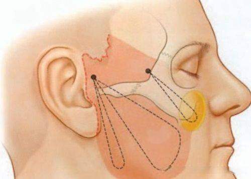 <strong>四、在抚州梦婷医疗美容做吸脂，术后要注意什么及如何预约？</strong>