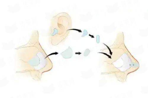 <strong>二、平顶山星美医疗美容的全切双眼皮医生团队靠谱吗？</strong>