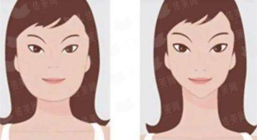 <strong>三、重庆明好医院植发的微针植发流程与术后养护是怎样的？</strong>