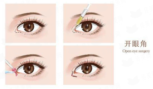 <strong>三、<strong>邯郸丽人整形在鼻修复技术上有何独到之处？</strong></strong>