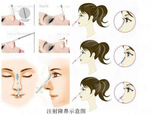 <strong>三、在邯郸丽人整形做隆胸，价格与预约流程是怎样的？</strong>