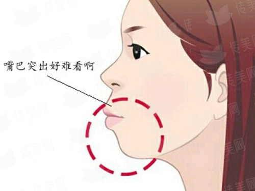 <strong>三、<strong>邯郸丽人整形做私密紧致，医生专精吗？</strong></strong>