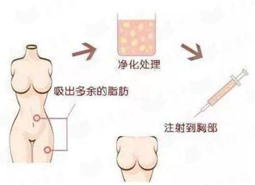 <strong>二、重庆明好医院植发的医生团队和专精度如何？</strong>