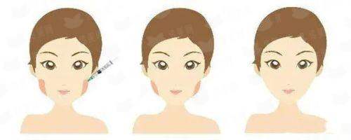 <strong>三、东莞晗悦医疗美容耳软骨隆鼻的术后修复与护理指南</strong>