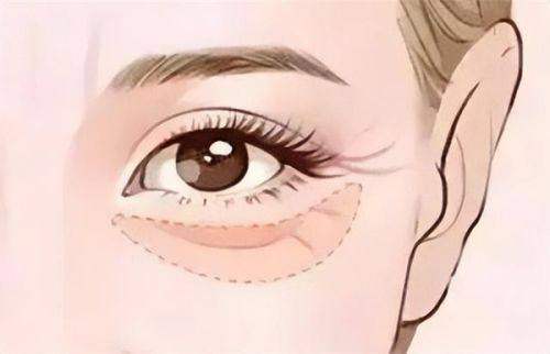 <strong>四、<strong>邯郸丽人整形私密紧致如何预约与面诊？</strong></strong>