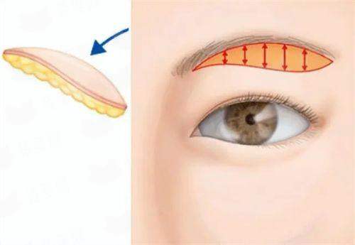 <strong>三、抚州地区隆鼻项目价格与选择参考</strong>