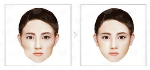 抚州梦婷医疗美容隆鼻案例推荐，价格了解与预约方式，新颜智尚小程序轻松搞定