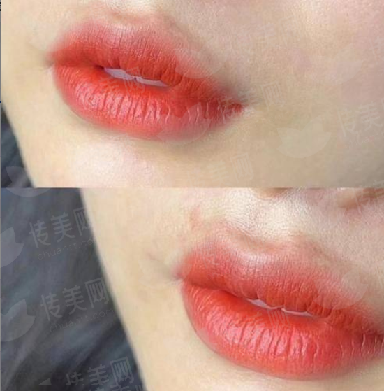 <strong>二、四川成都现代整形医院的下颌角整形医生团队靠谱吗？</strong>