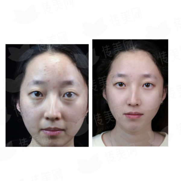 <strong>四、如何预约四川成都现代整形医院的李献和医生进行颌面整形面诊？</strong>