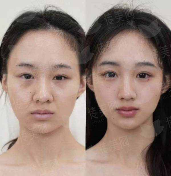 抚州梦婷吸脂价格、案例、地址一站式了解，新颜智尚小程序预约