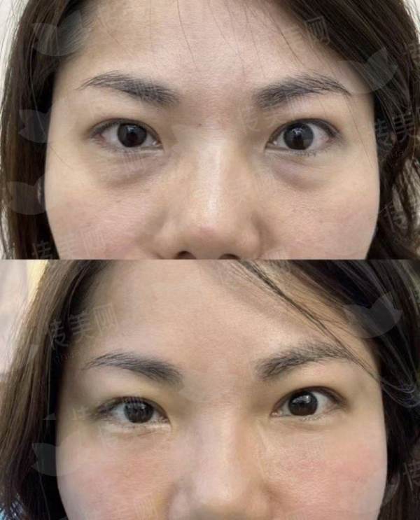 <strong>三、选择邵阳格莱美医疗美容做隆胸有什么独特优势？</strong>