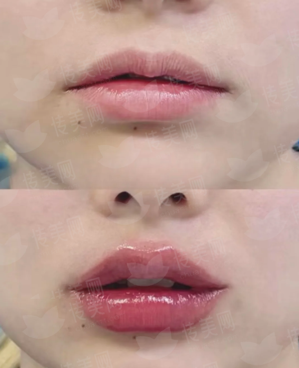 <strong>四、如何预约沈阳腾采医疗美容的吸脂面诊？同城项目如何理性选择？</strong>