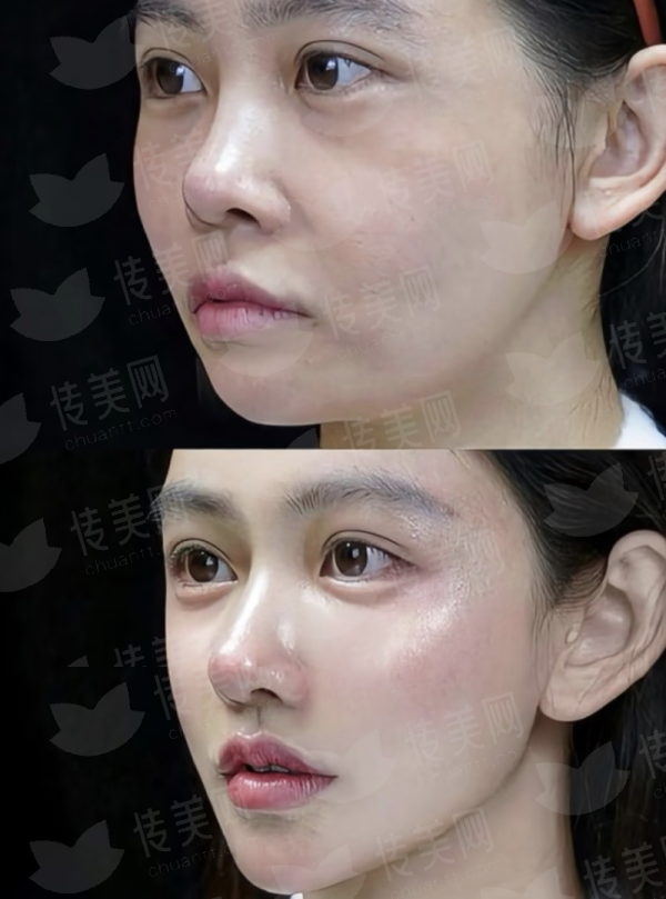 想去徐州和平妇产医院割双眼皮？新颜智尚一键预约，了解价格及医生案例推荐