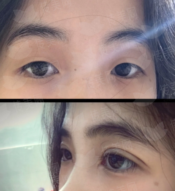 <strong>三、在平顶山做轮廓固定，星美医疗美容的价格与预约方式详解</strong>