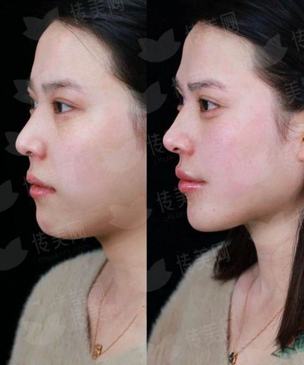 <strong>三、<strong>四川成都现代整形医院的术后修复与护理体系完善吗？</strong></strong>