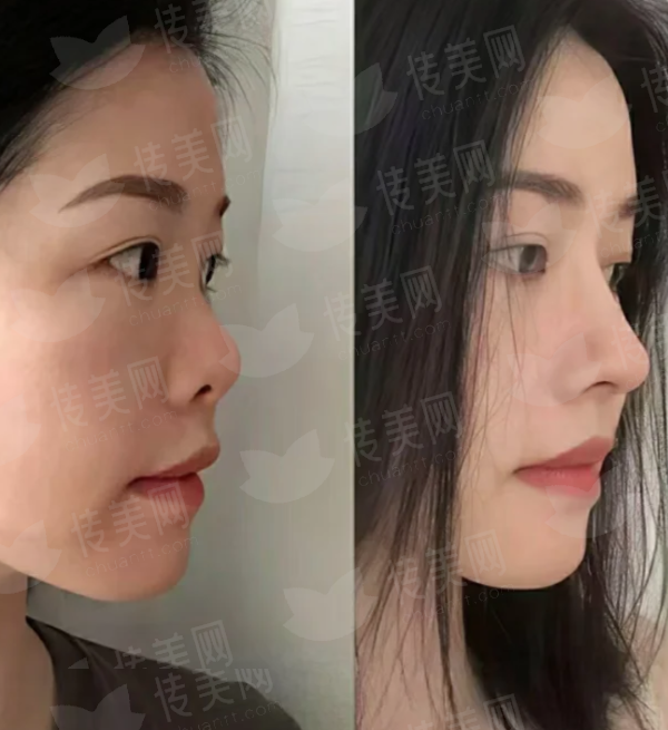 浙江杭州整形医院隆胸手术预约指南，新颜智尚小程序可约，含医院介绍与详细地址