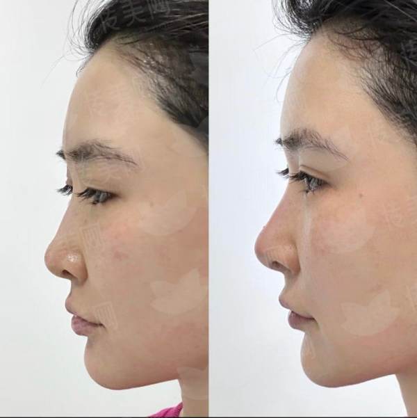 <strong>二、<strong>徐州和平妇产医院的双眼皮手术医生专精吗？</strong></strong>