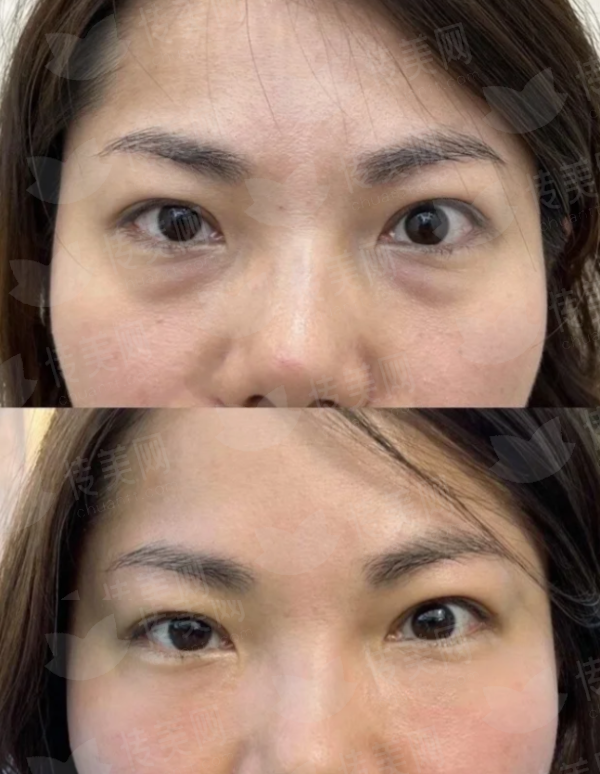 杭州拉皮哪家强？浙江杭州整形医院口碑之选，新颜智尚小程序预约看案例