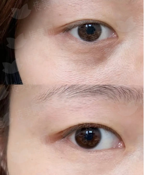 <strong>二、<strong>邯郸丽人整形的私密紧致项目价格贵吗？</strong></strong>