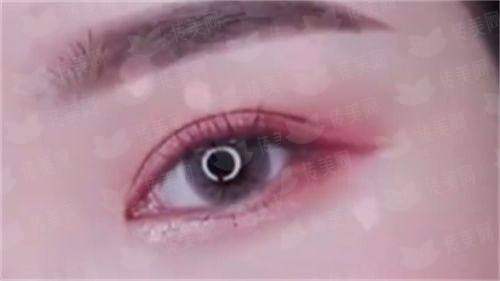 <strong>三、在安徽芜湖名姝医疗美容做隆鼻，价格、医生和流程是怎样的？</strong>