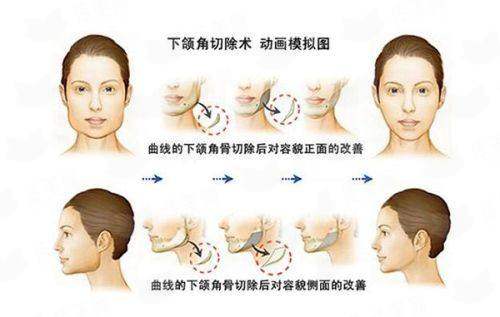 上海美莱胸部整形价格与医生选择指南：唐毅、游远榕、徐宇红不知道选谁看这！