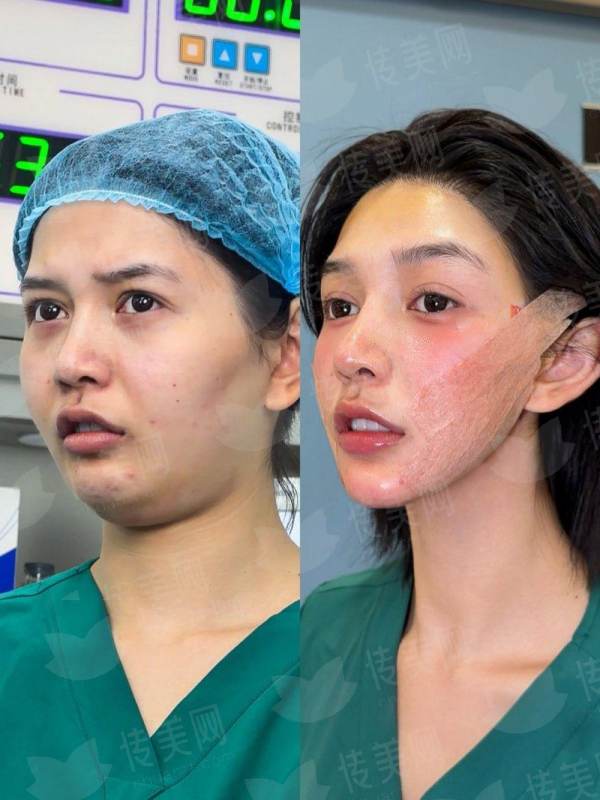 安徽芜湖名姝隆鼻价格了解，包含医院特色技术，地址信息，新颜智尚小程序可约