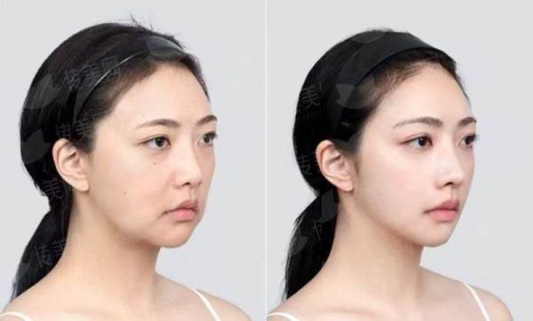 <strong>三、贵阳美和医疗美容医院的收费和口碑真实情况如何？</strong>