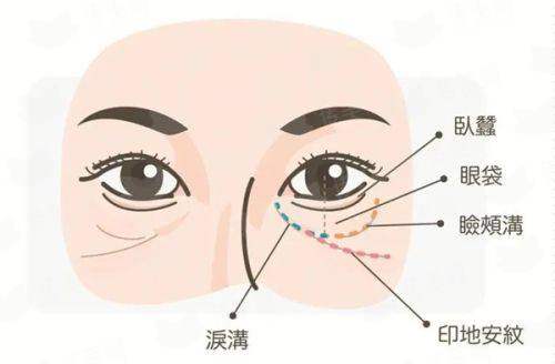 <strong>三、上海华美医疗美容的眼修复有什么优势？</strong>