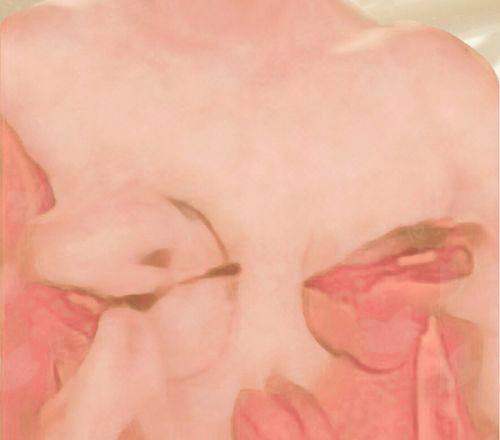 <strong>四、关于武汉美基元汪福强胸部整形，美亲们还需要了解哪些？</strong>