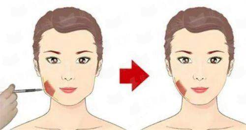 <strong>四、在上海韩卓找张强院长做肋骨鼻，该如何准备与选择？</strong>