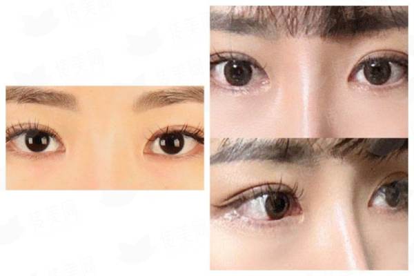 <strong>四、<strong>关于南宁爱思特耳再造的常见问题与预约指南</strong></strong>