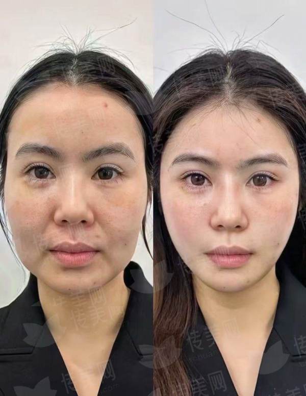 想预约武汉美基元汪福强做胸部整形？新颜智尚小程序一键预约，附案例与价格攻略