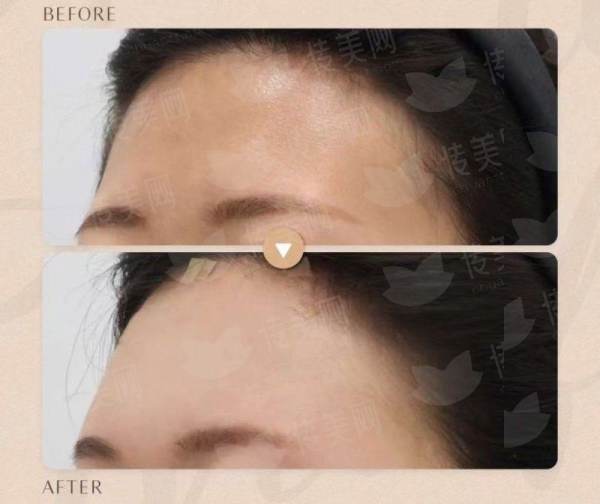 <strong>二、<strong>耳再造技术怎么选择？不同方法在南宁爱思特的运用</strong></strong>