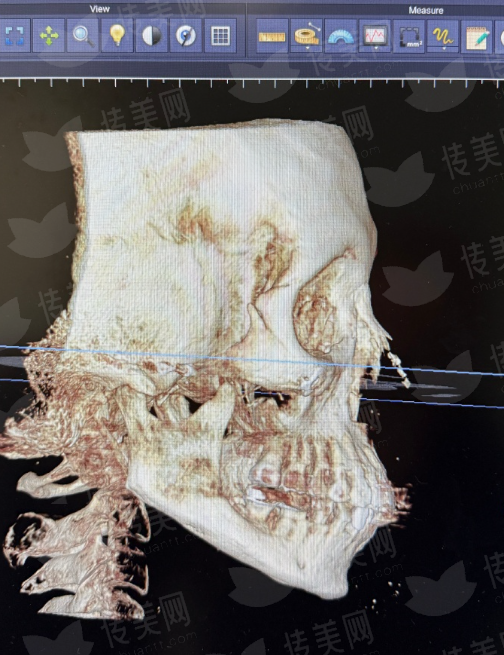 <strong>二、选择武汉美基元做汪福强胸部整形，医院环境和假体选择有何优势？</strong>