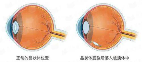 二、房永刚医生：眼部精细化手术的技术理念与专长