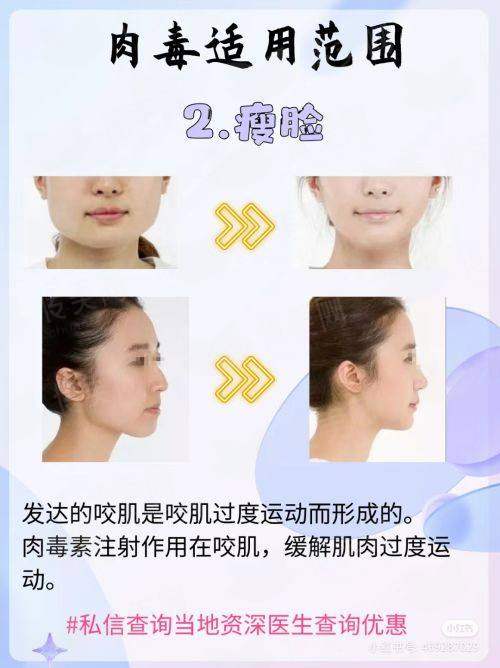 三、真实实例与术式选择：从术前设计到术后蜕变