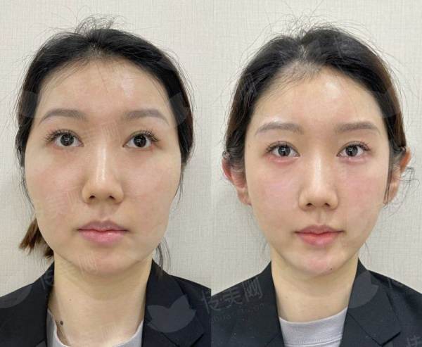 沈阳友谊刘金超眼修复技术怎么样？医生简介&特色项目解析，附价格表&案例参考-新颜智尚小程序一键预约！