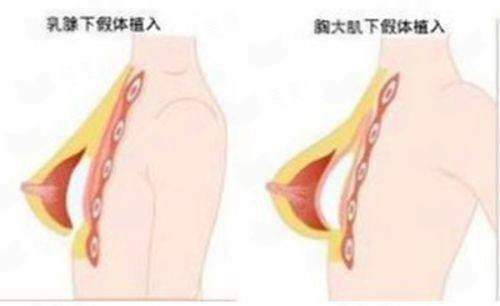 沈阳鼻综合必看！辽宁曙光于世川原生态鼻整形特色项目&风格优势大揭秘，附预约方式-新颜智尚小程序预约省心快速