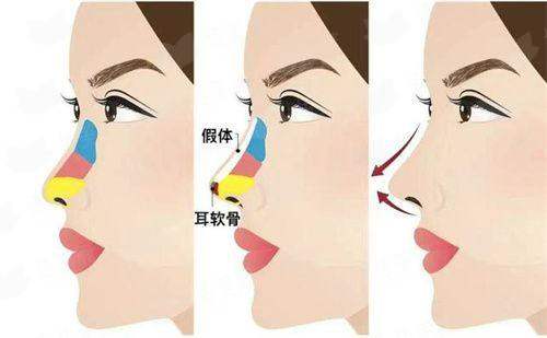探秘大同曼姿医疗美容无痕去眼袋，医生简介特色项目口碑反馈-新颜智尚小程序+APP预约