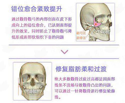 德州天宏医疗美容王圣雷假体隆鼻，特色项目优势特点与电话号码-新颜智尚小程序预约