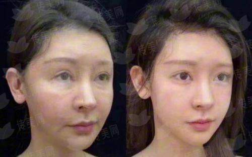 长沙华韩华美整形口腔医院肖培卫双眼皮,医生简介特色项目价格表预约方式-新颜智尚小程序一键预约！